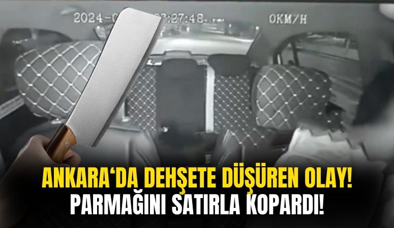 Ankara'da Bir Taksici Satırlı Saldırıya Uğradı! Parmağı Koptu